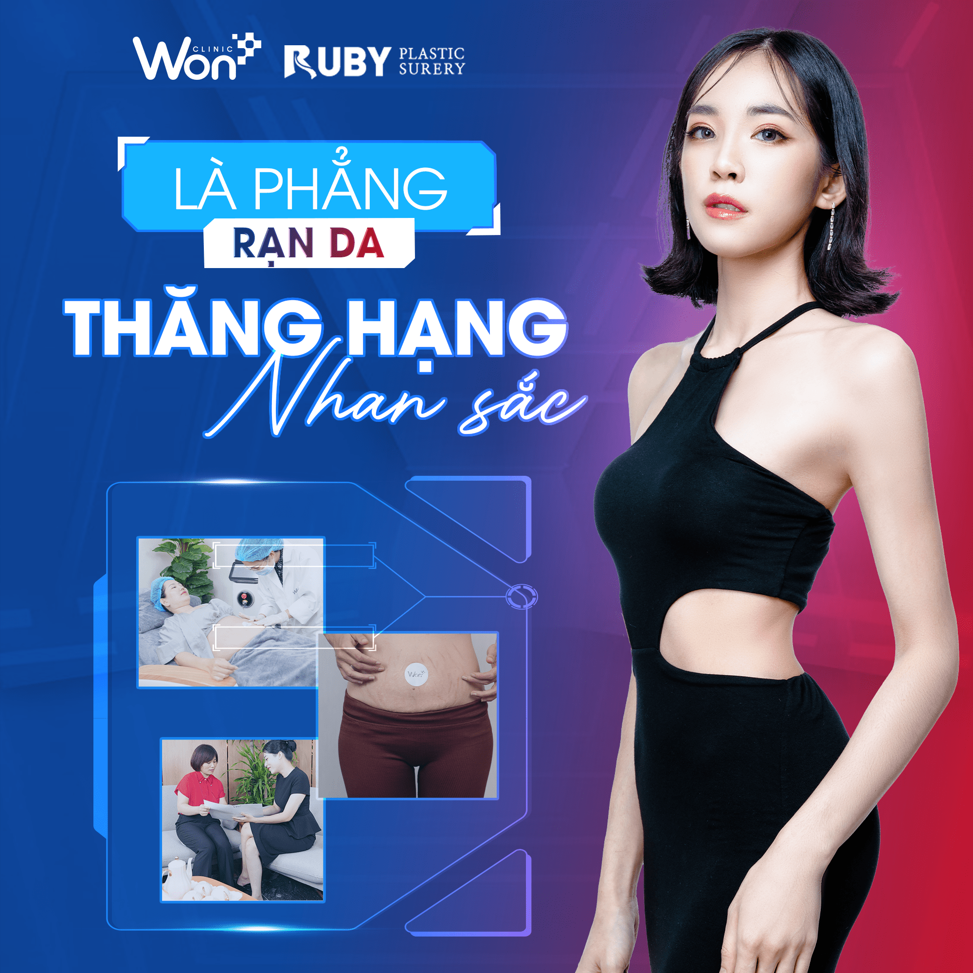 Công Nghệ Điều Trị Rạn Da Matrix Plus – Giải Pháp Hiệu Quả